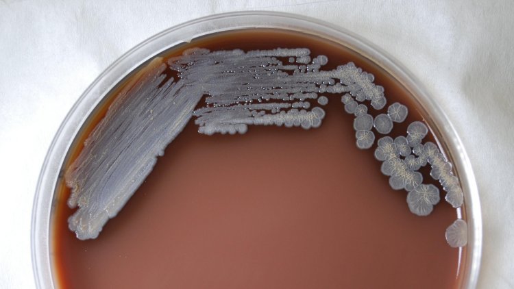 CDC, Doktorları Kökeni Açık Olmayan Gizemli Bir Bakteri Salgını Hakkında Uyardı